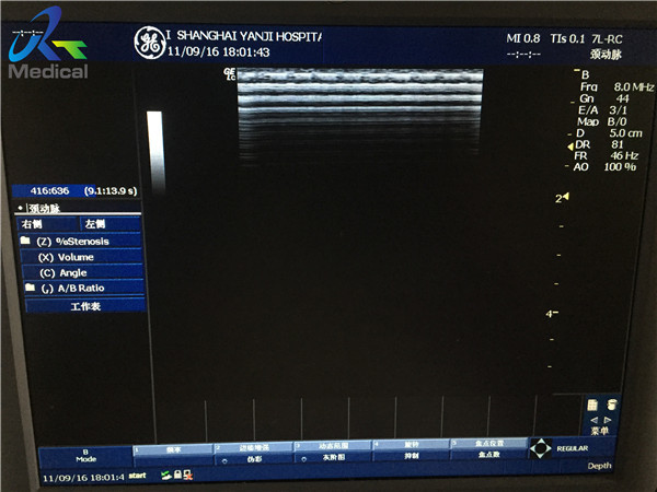 Wide Band Linearx Used Ultrasound Probe GE 7L RC
