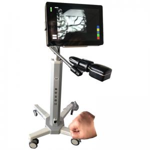 China Medical Portable Vein Locator Device Spider Vein Removal Machine Imaging Depth &lt; 10mm wholesale