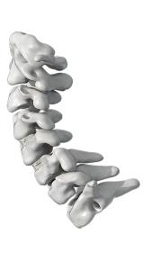 China ISO PEEK Spinal Fusion Cage Degenerative Disc Disease Cervical Fusion Cage wholesale