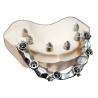Buy cheap FDA 3014652903 PFM bridge dental Highly Aesthetic Extremely Strong from wholesalers
