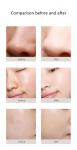 Facial Pdt Light Oxygen Therapy Machine Micro Current , 250W Jet Peel Facial