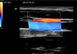 Color Doppler Ultrasound Probe Handheld Ultrasound Device For Mobilephone / PC