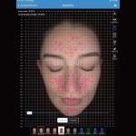 Beauty Spa Face Analyzer Machine Fast Detective 5 Spectra Skin Analysis