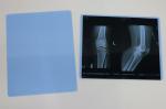 class I Medical Dry Thermal Sensitive Film for Inkjet Printer