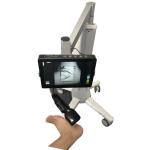 Medical Vein Finder Safe Light Source Infrared Vein Finder No Laser With No