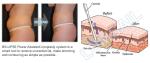 3 In 1 Surgical Vacuum Liposuction Cavitation Machine / Fat Reduction Equipment