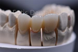 China Customizable Thickness Multilayer Zirconia Ceramic Dental Material wholesale