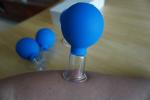 4Pcs/Set Blue Vacuum Cupping Cups PVC Head Glass Suction Body Massage Family