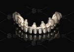 Hybrid Pink Porcelain Implant Crown Malong Full Arch Implant Bridge Immediate