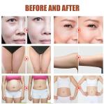 Fat Vacuum Cavitation System Liposuction 40k 80k Cavitation Slimming Machine RF