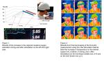 810nm Near Infrared Led Light Photobiomodulation Helmet For Brain Treatment