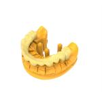 Permanent Crown Bridge Resin with 2 Years Shelf Life and High Shore D 92