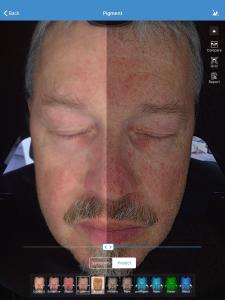 China Face Skin Analyzer For Clinic Face Care Test , Facial Skin Analyzer wholesale