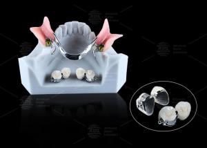 China CE FDA Ball Attachment Dentures Comfortable Denture Ball Attachment Long Lasting wholesale