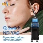 Skin Rejuvenation ND YAG Laser Machine Q Switched 1064nm Carbon Laser Peel