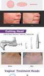 V10 30w 60w Portable Scar Removal Private Tightening Co2 Fractional Laser Beauty