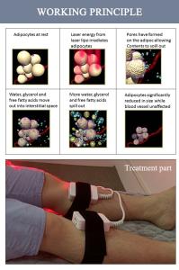China 980nm Lipo Laser Slimming Machine for Fat Burning Anti Cellulite wholesale