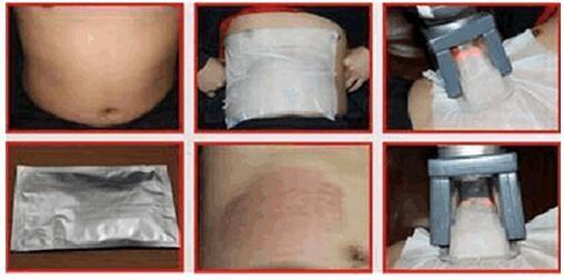 5 handles Cryolipolysis+Cavitation+RF Multifunction Machine(you can do the whole
