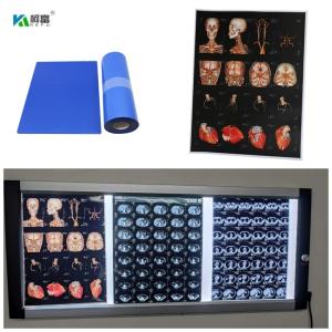 China Blue Base Medical Inkjet X Ray Film For Digital Image 280gsm For 14x17inch Color Image wholesale