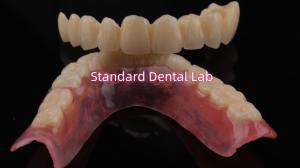 China Highly Durable And Natural-Looking Layered Porcelain For Layered Dental Zirconia Crown China Dental Lab wholesale