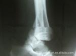 White Paper Laser X Ray Medical Imaging 8in x 10in Waterproof
