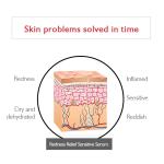 Oem Private Label Organic Anti-Redness Serum For Reducing Redness Facial Serum