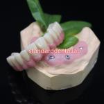 Screwed All On 6 Full Zirconia Bridge Dental High Accuracy Over Ti Base