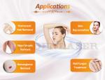 Q Switched Alexandrite Laser Hair Removal At Home 755nm Yag Laser Depilation