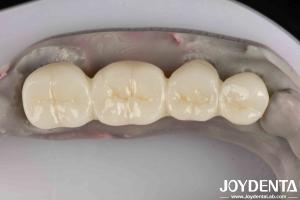 China Excellent White Product Full Zirconia With High Resistance To Corrosion Capability wholesale