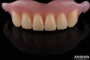 China Natural Looking Dental Complete Denture Odor Resistant Adjustable For Proper Fit wholesale