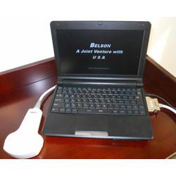 China USB Color Handheld Ultrasound Scanner , Portable Ultrasound Device Lightweight wholesale