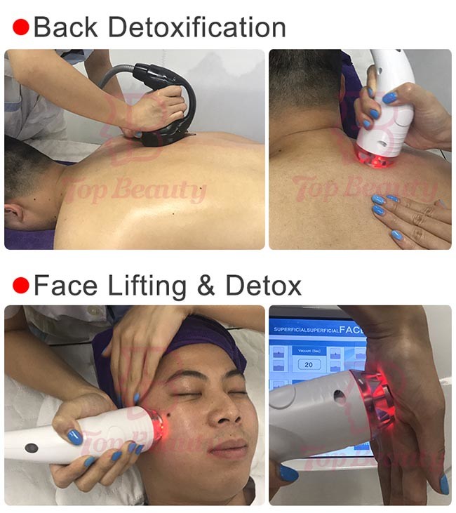 Fat Burning EMShapeing Skin Tightening Iii Machine