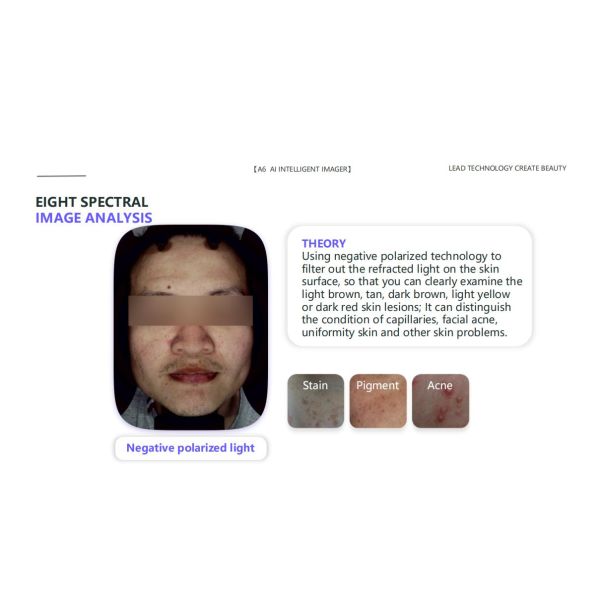 GMS- A6 Al Intelligent Face Analyzer Machine 8 Spectral Imaging Technologies for One Click Analysis of 15 Skin Problems