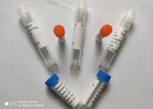 China Recombinant Anti COVID 19 Mouse Monoclonal Antibodies Mab Monoclonal Antibody wholesale