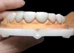 Custom Translucent Zirconia Dental Crown With High Durability Stain Resistant