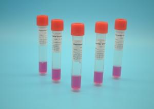 China PP Cotton Virus Specimen Collection Tube Consumable Medical Supplies wholesale