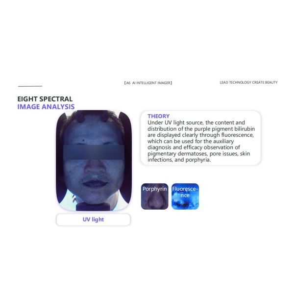 GMS- A6 Al Intelligent Face Analyzer Machine 8 Spectral Imaging Technologies for One Click Analysis of 15 Skin Problems