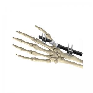 China Extra Articular Wrist External Fixator Cross Joint Wrist Ex Fix wholesale