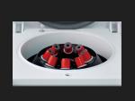 TD4D Low Speed PRP Centrifuge 4000rpm 5ml 10ml 15ml 20ml