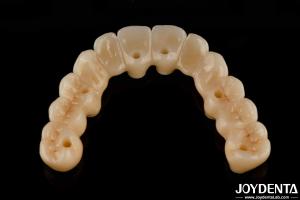 China High Flexibility Zirconia Hybrid Bridge With Titanium Base High Aesthetic wholesale