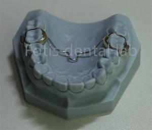China Versatile Dental Expander Retainer Affordable Solution for Most Orthodontic Treatments wholesale