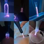 Cold Plasma Device Acne Treatment Machine Ozone Plasma Hair Growth Face Lifting