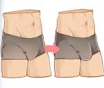 Sodium Hyaluronate Ha Filler Injection For Penile Enlargement