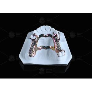 Sensitive Skin High Strength Titanium Framework Solution 3D Printed