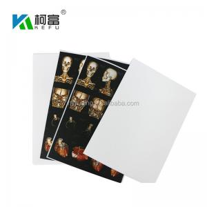 China A3 A4 Medical Waterproof Inkjet Film CT CR MR DR Digital X Ray Film wholesale