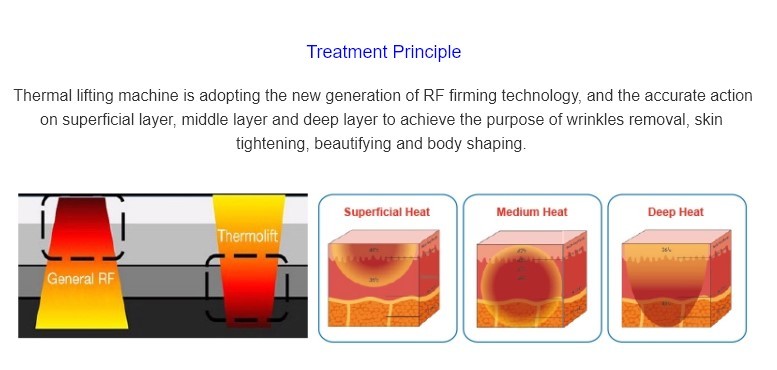 Rf Eye Skin Lifting Tightening Best Radio Frequency Machine rf skin tightening machine