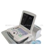 Professional Body High Intensity Focused Ultrasound scanner Human Care Machine