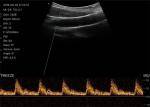 Colour Doppler Ultrasound Scanner Doppler Ultrasound Device With 128 Elements 13