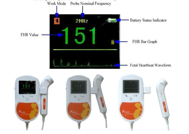Ultrasound Equipment Pocket Fetal Doppler Built In Speaker Color Display