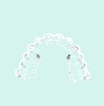 High Strength Orthodontic Bracket Adhesive Resin Fast Curing